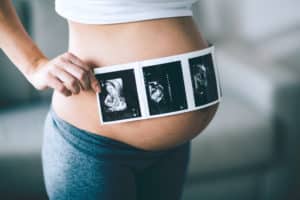 Pregnancy Ultrasound Columbus, OH